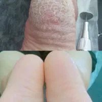 اسپا پا .کاشت ناخن|خدمات آرایشگری و زیبایی|ایلام, |دیوار