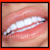 دندانپزشکی کامپوزیت/عصبکشی/ترمیم دندان/روکش بریج|خدمات آرایشگری و زیبایی|تهران, میدان ولیعصر|دیوار