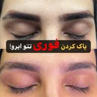 ریموو،میکروبلیدینگ،خط چشم و شیدینگ|خدمات آرایشگری و زیبایی|کرمانشاه, |دیوار