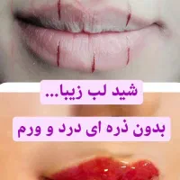 میکروبلیدینگ وشی لب درمنزل شما باقیمت باورنکردنی|خدمات آرایشگری و زیبایی|کرمان, |دیوار