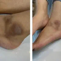 رفع تیرگی صورت وبدن فیشال تخصصی|خدمات آرایشگری و زیبایی|تهران, سلسبیل جنوبی|دیوار