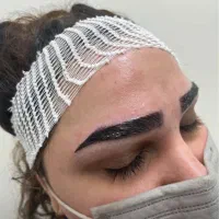 مدل کاشت ابرو (بدون جراحی)