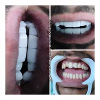 لبخند زیبا