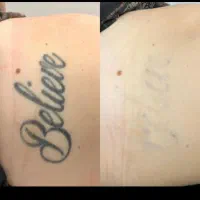 لیزر تتو های قدیمی تتوی صورت و بدن فقط ۵۰۰|خدمات آرایشگری و زیبایی|فولادشهر, C3|دیوار