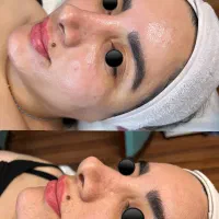 پاکسازی پوست ودرمانی پوست|خدمات آرایشگری و زیبایی|اهواز, کیانپارس |دیوار