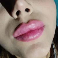 جشنواره ژل و بوتاکس|خدمات آرایشگری و زیبایی|کاشان, کشاورز|دیوار