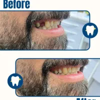 دندان مصنوعی اقساط و بیمه|خدمات آرایشگری و زیبایی|کرمان, |دیوار