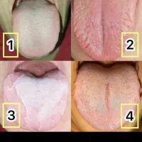 سونوی زبان ومشاوره