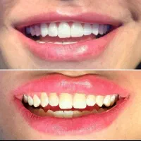 دندانپزشکی قسطی،جشنواره خدمات زیبایی