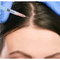 مزوتراپی مو و ابرو‌و جوانسازی صورت