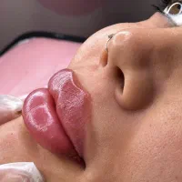 خدمات و اموزش تخصصی ژل و بوتاکس تضمینی (عملی)|خدمات زیبایی و سلامت|تهران, نازیآباد|دیوار