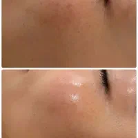 پاکسازی وفیشال پوست|خدمات آرایشگری و زیبایی|قم, صدوق|دیوار