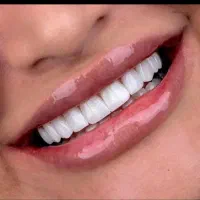 کامپوزیت|خدمات آرایشگری و زیبایی|اهواز, گلستان|دیوار