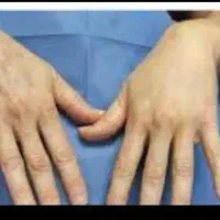 ساکشن|خدمات آرایشگری و زیبایی|رشت, سعدی (تختی)|دیوار