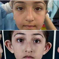 جراحی زیبایی