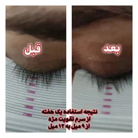 آرایشی و بهداشتی و مشاوره رایگان تراست|آرایشی، بهداشتی، درمانی|کرمان, |دیوار