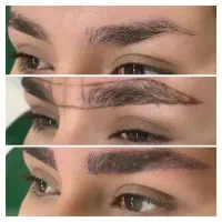 آف ویژه میکروبلیدینگ و فیبروز