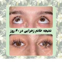 مژه ها و ابروهات رو تقویت و زیبا کن|خدمات آرایشگری و زیبایی|شیراز, ارم|دیوار