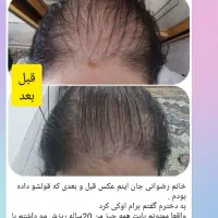 درمان  تمام مشکلات پوستی مو دهان ک دندان|آرایشی، بهداشتی، درمانی|تهران, فرمانیه|دیوار