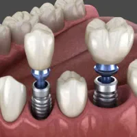 استخدام دستیار دندانپزشکی
