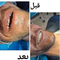 خدمات دندان پزشکی|خدمات آرایشگری و زیبایی|بروجرد, |دیوار