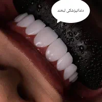 خدمات دندانپزشکی (بانرخ تامین اجتماعی )