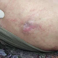 کارشناس زخم/خدمات تخصصی پرستاری در منزل|خدمات آرایشگری و زیبایی|اصفهان, شهید رجایی|دیوار
