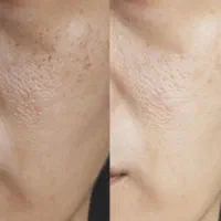 گیاهی روشن کننده ضدلک ۳ روز|خدمات آرایشگری و زیبایی|ایرانشهر, |دیوار