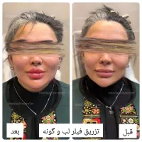 پوست مو زیبایی