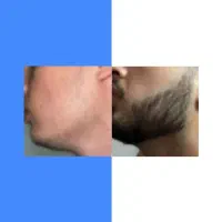 صورتت منتظر این تغییره