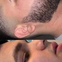 ریش مو