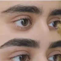 اصلاح صورت و ابرو تخفیف ویژه