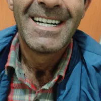 دندان ساز تجربی صدف با بیش از پانزده سال سابقه|آرایشی، بهداشتی، درمانی|سریش آباد, |دیوار