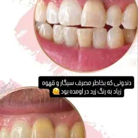 تخفیف خدمات دندانپزشکی و شرایط پرداخت اقساط|خدمات آرایشگری و زیبایی|رشت, گلسار|دیوار