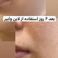 جوانسازی|آرایشی، بهداشتی، درمانی|شیراز, ابیوردی|دیوار