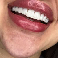جشنواره تابستانی دندانپزشکی زیبایی