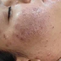 فشیال|خدمات آرایشگری و زیبایی|مشهد, ایثار|دیوار