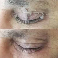 برای همیشه از شرش خلاص شو تو کوتاه ترین زمان ممکن