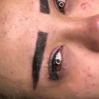 میکروبلیدینگ و تاتو