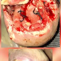 کارشناس و درمانگر زخم ،خدمات پرستاری در منزل|خدمات آرایشگری و زیبایی|برازجان, |دیوار