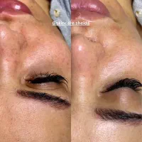 پاکسازی و فیشال پوست در کلینیک زیبایی-آموزش|خدمات آرایشگری و زیبایی|اهواز, کیانپارس |دیوار
