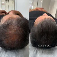 پوست و مو|خدمات آرایشگری و زیبایی|اصفهان, باغ فدک|دیوار