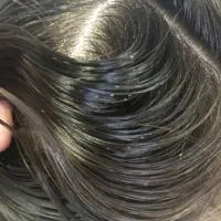 پایان کابوس شپش سر|آرایشی، بهداشتی، درمانی|آزادشهر, |دیوار