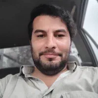کاشت مو وابرو