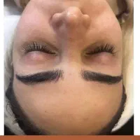 پاکسازی و فیشال پوست