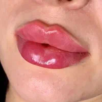 مزوژل آنزیم چربی اگزوزوم بادی بایوفیلر لیفت ژل ۴۹۰|خدمات آرایشگری و زیبایی|کرج, گوهردشت|دیوار