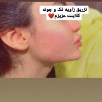 آموزش و انجام تمام خدمات ژل و بوتاکس|خدمات آرایشگری و زیبایی|هشتگرد, شهرک ولیعصر (مصلی)|دیوار