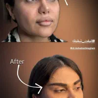 جراحی‌های صورت وبدن-اقساط