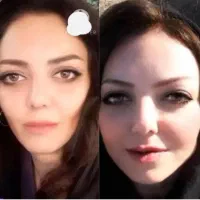 تپلی فوری صورت (چاقی صورت در ۱۰‌روز)|خوردنی و آشامیدنی|رشت, کاکتوس|دیوار