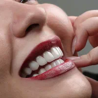 اقساط ویژه ایمپلنت دیجیتال،اوردنچر،دندان مصنوعی..|خدمات زیبایی و سلامت|تهران, دبستان|دیوار